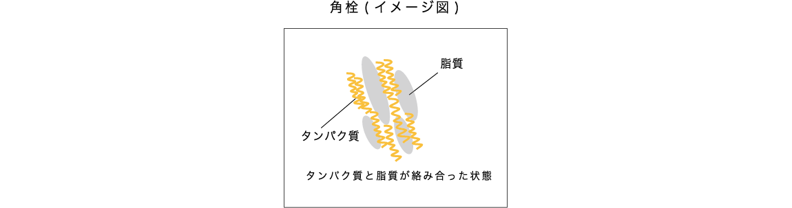 角栓(イメージ図) タンパク質と脂質が絡み合った状態